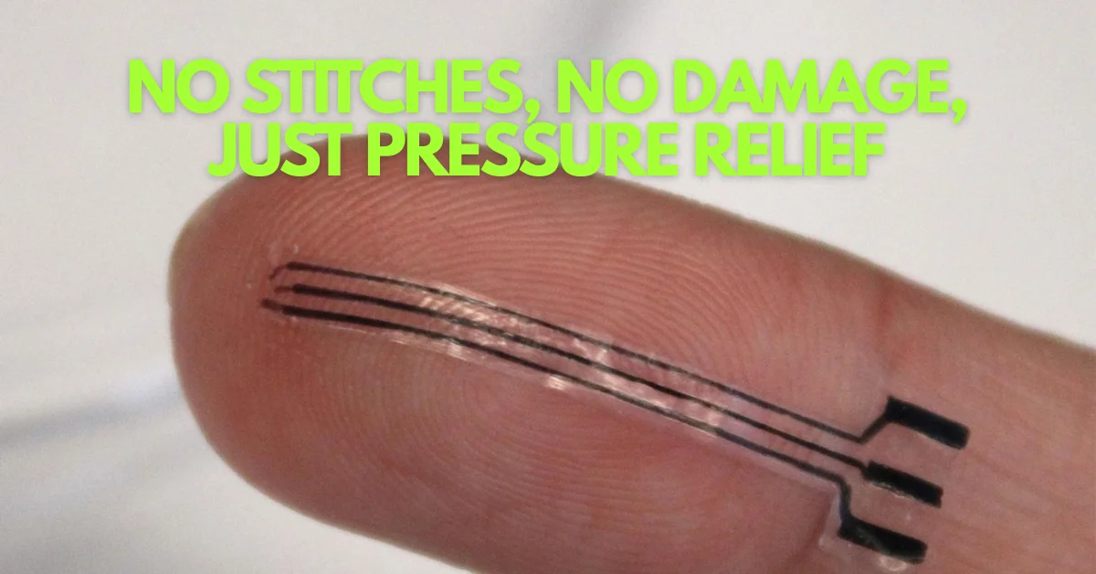 Soft Electronic Implant Whispers to Arteries, Lowers Blood Pressure Without Stitches